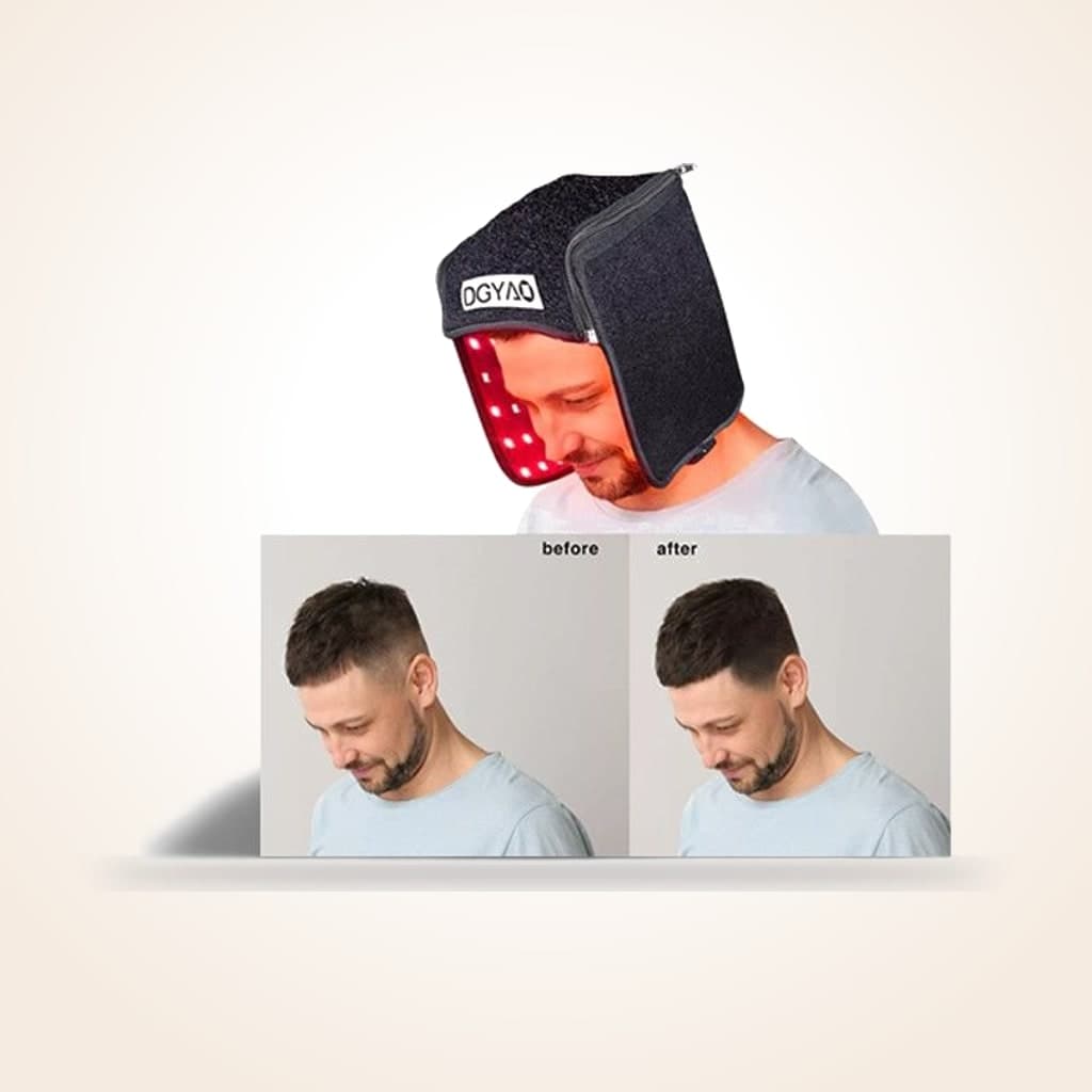 Red Light Therapy Laser Helmet